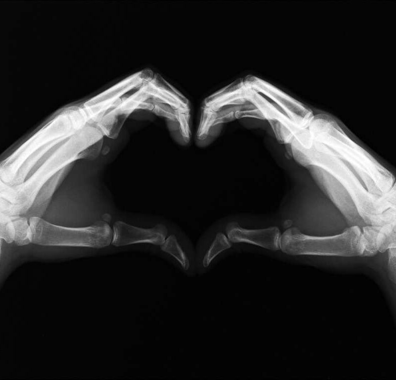 Urgent care Xray Image