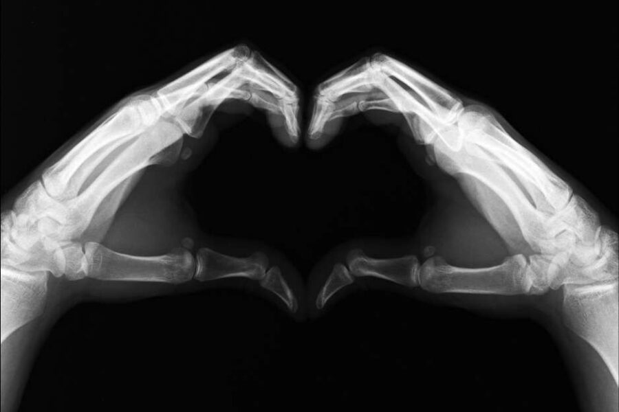 Urgent care Xray Image