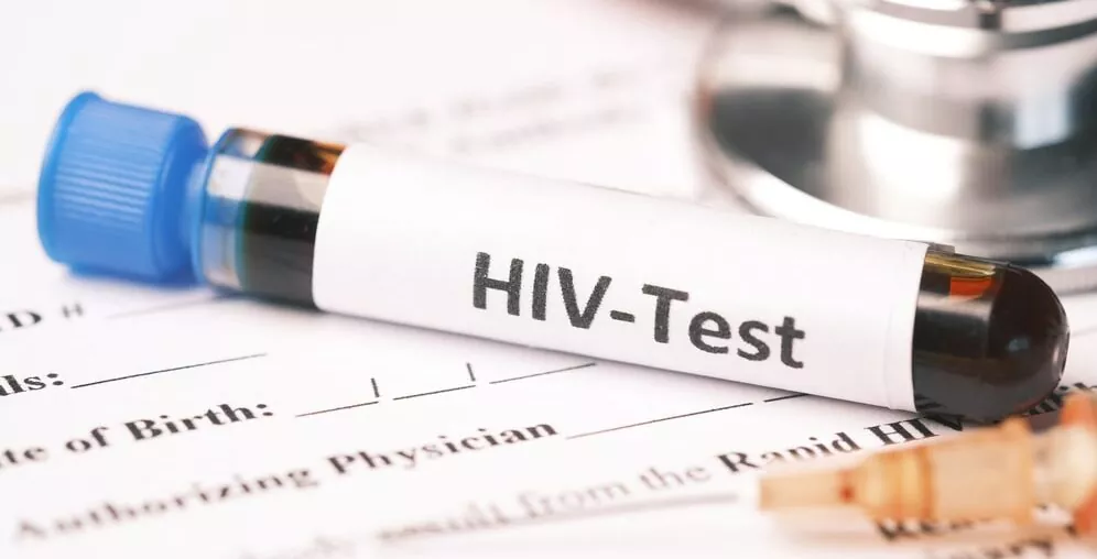 rapid hiv testing
