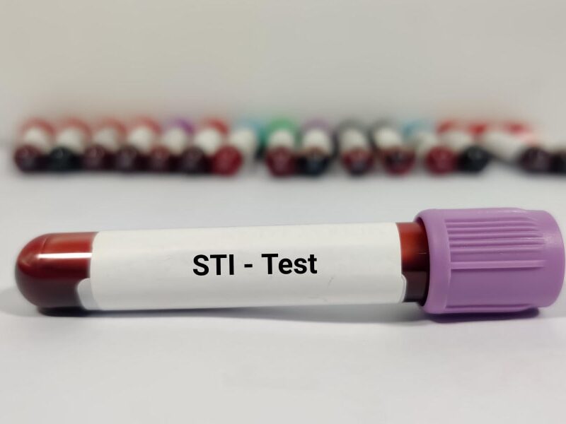 std testing under health insurance