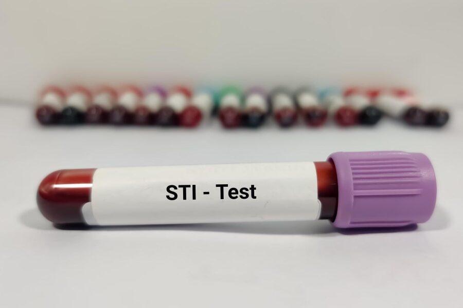 std testing under health insurance