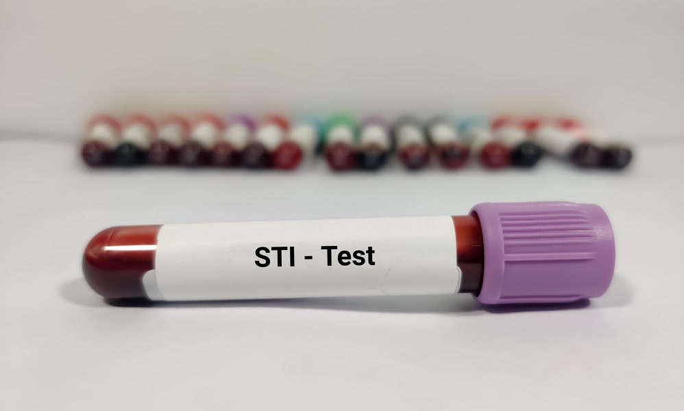 std testing at urgent care