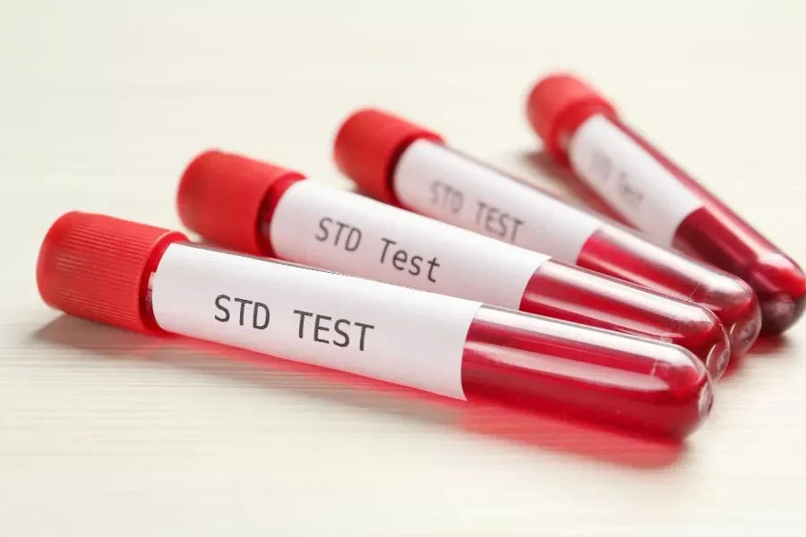 std testing