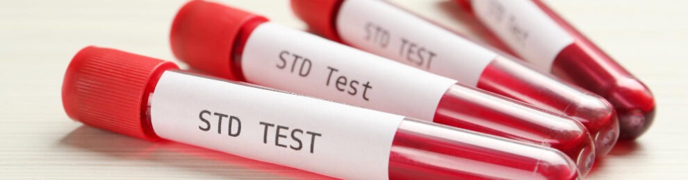 How Often Should You Get STD Tested?