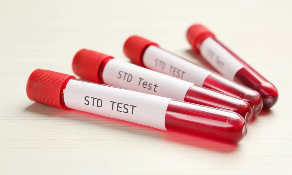 std blood test accuracy