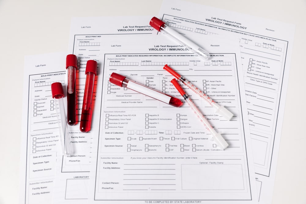 Essential Blood Work Tests Before Surgery: What You Need to Know