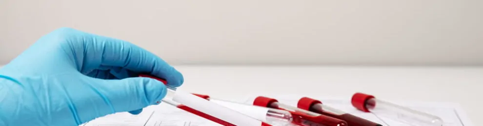 Finding the Right Frequency for Blood Work: How Often Should You Get Tested?