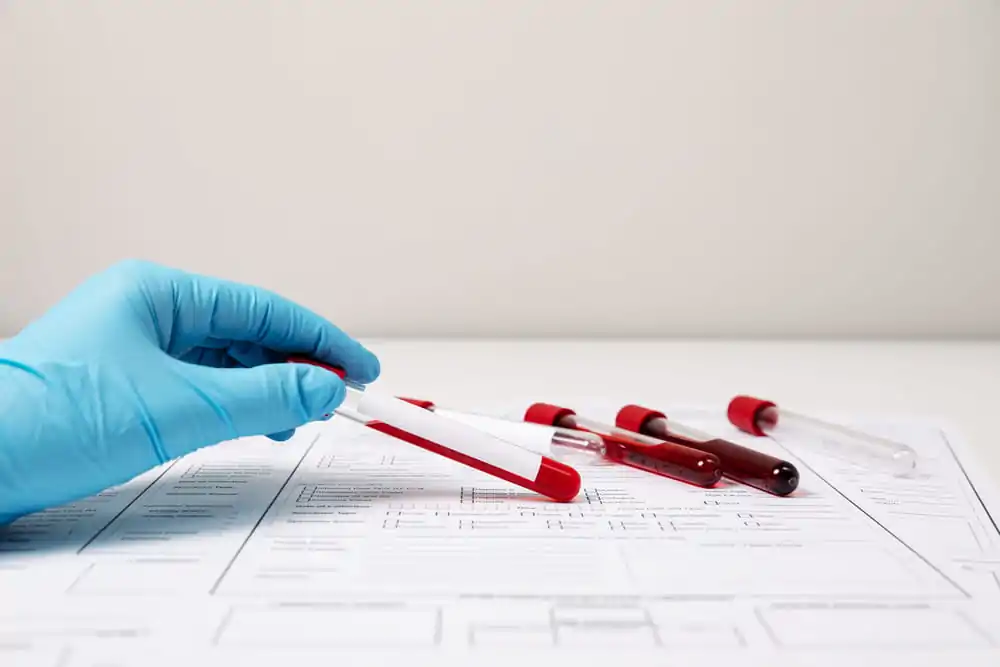 Finding the Right Frequency for Blood Work: How Often Should You Get Tested?