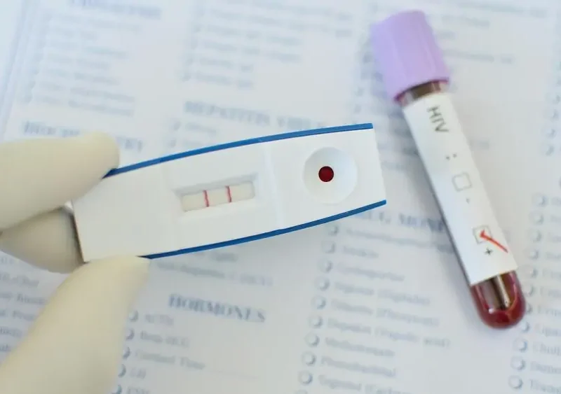 std testing kit