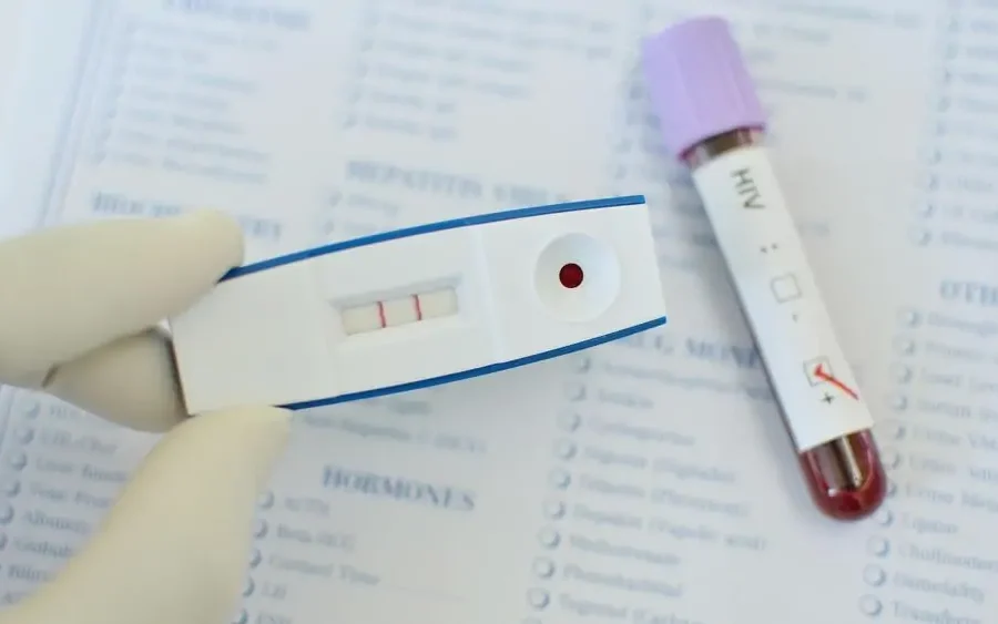std testing kit