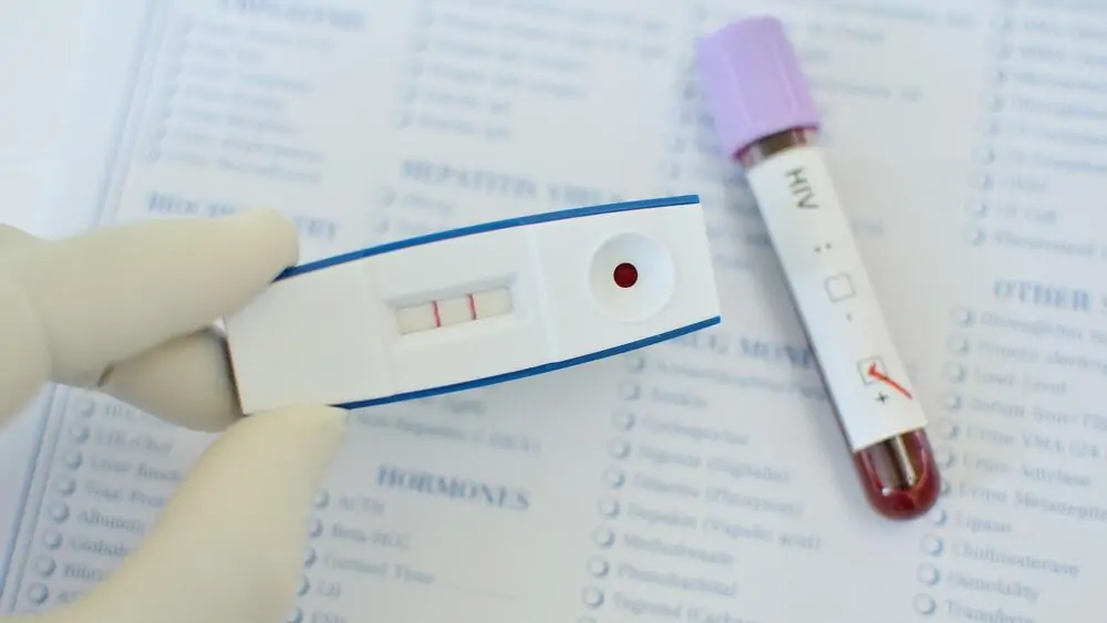 std testing kit