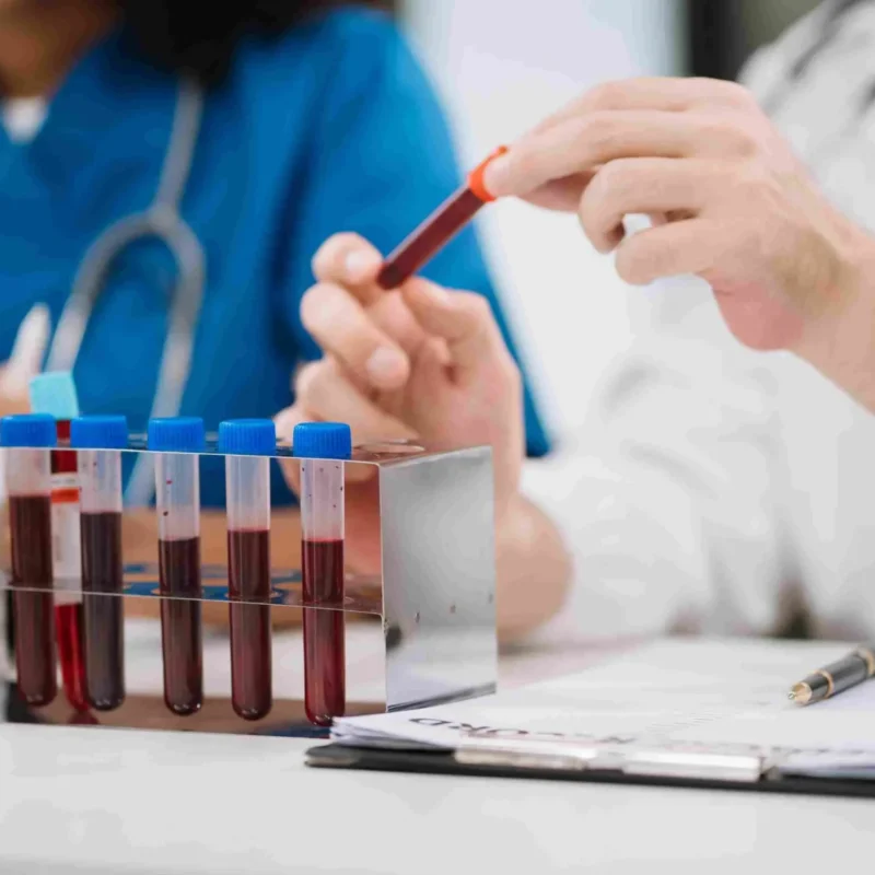 Blood test for liver and kidney problems