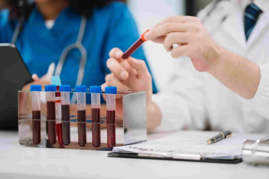 Blood test for liver and kidney problems