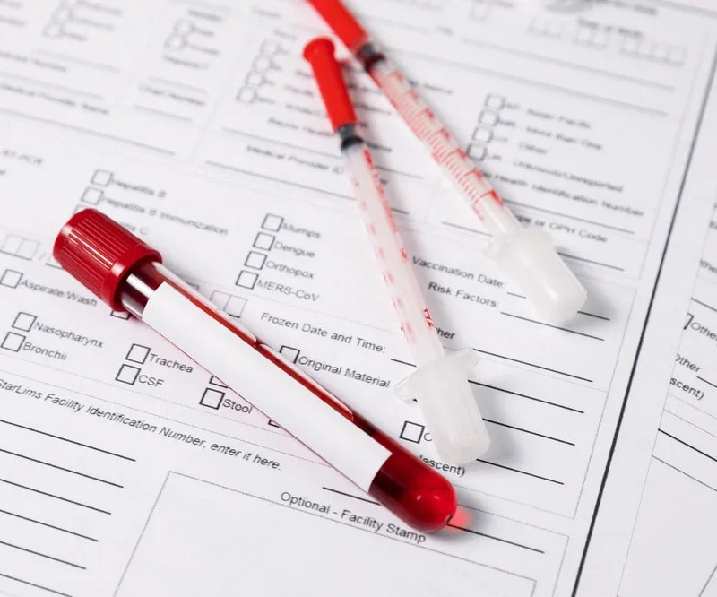 can you get stds from kissing and sharing food?