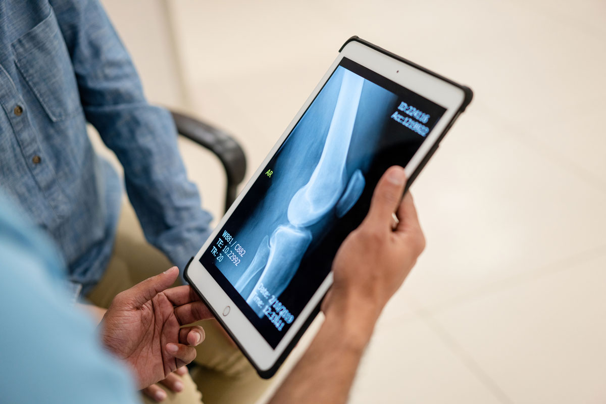 Doctor looking at X-ray in Pasadena.