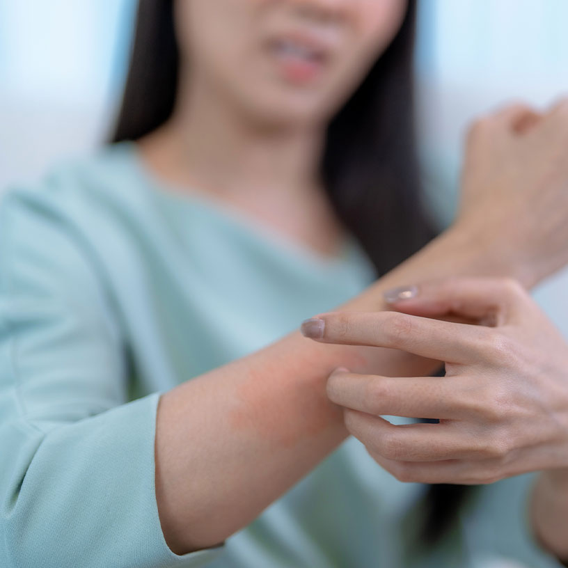 Scratches, Scrapes, and Cuts: How to Care for Them at Home and How to Spot an Infection Early